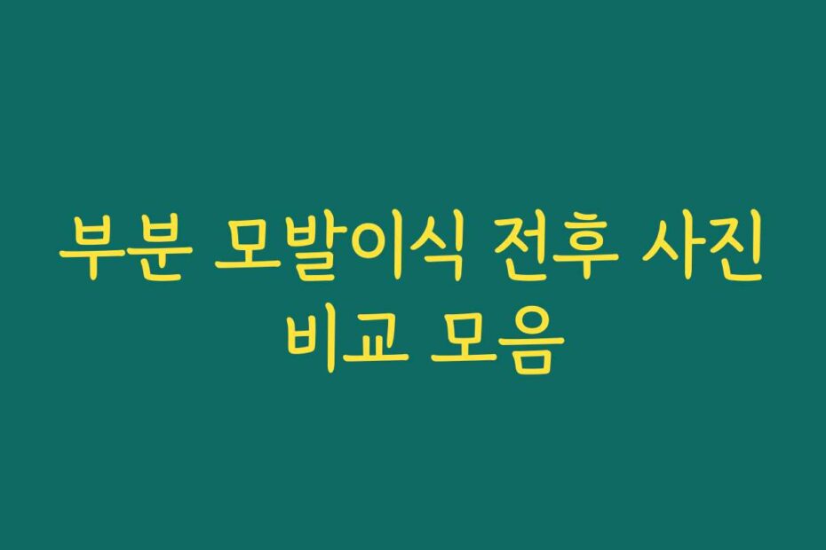 부분 모발이식 전후 사진 비교 모음